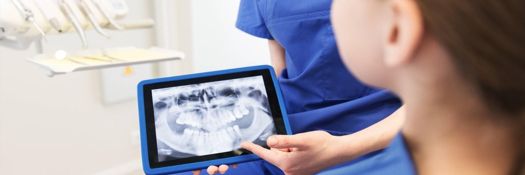 Digital Dental X-Rays | Dentist